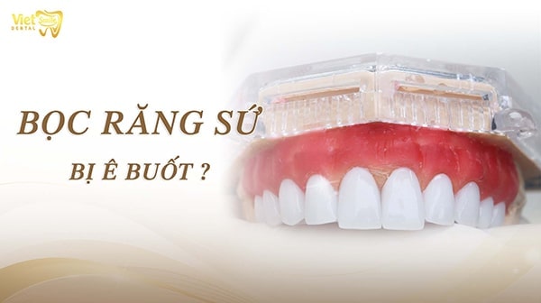 Nguyên nhân tại sao bọc răng sứ bị ê buốt và cách khắc phục hiệu quả