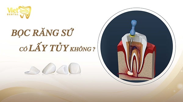 Bọc răng sứ có lấy tủy không? Những trường hợp không phải lấy tủy?