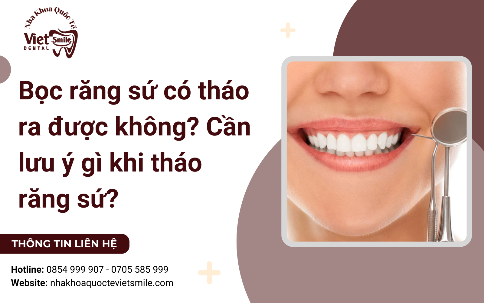 Bọc răng sứ có tháo ra được không? Cần lưu ý gì khi tháo răng sứ?