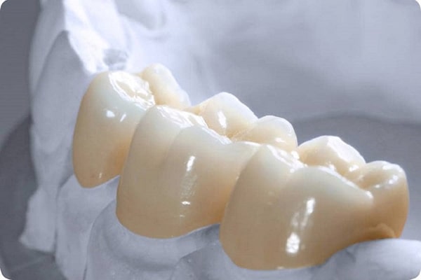 Răng sứ Zirconia là gì? Nguồn gốc từ đâu?