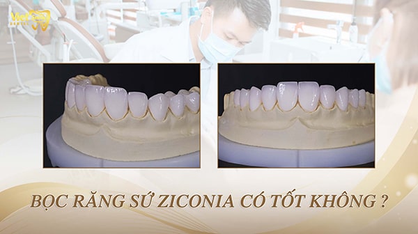 Bọc răng sứ Zirconia là gì? Liệu sứ Zirconia có thật sự tốt không?