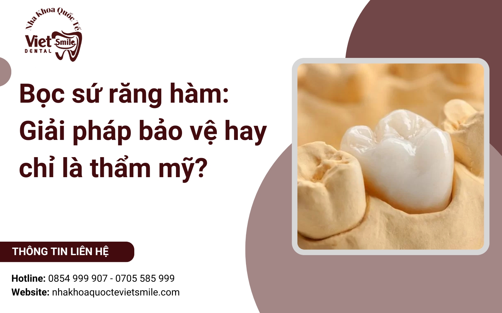 Bọc sứ răng hàm: Giải pháp bảo vệ hay chỉ là thẩm mỹ?