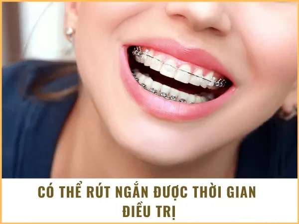 Thời gian điều trị nhanh chóng