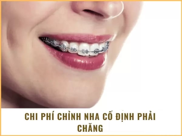 Chi phí phải chăng