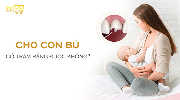 Cho con bú có trám răng được không?