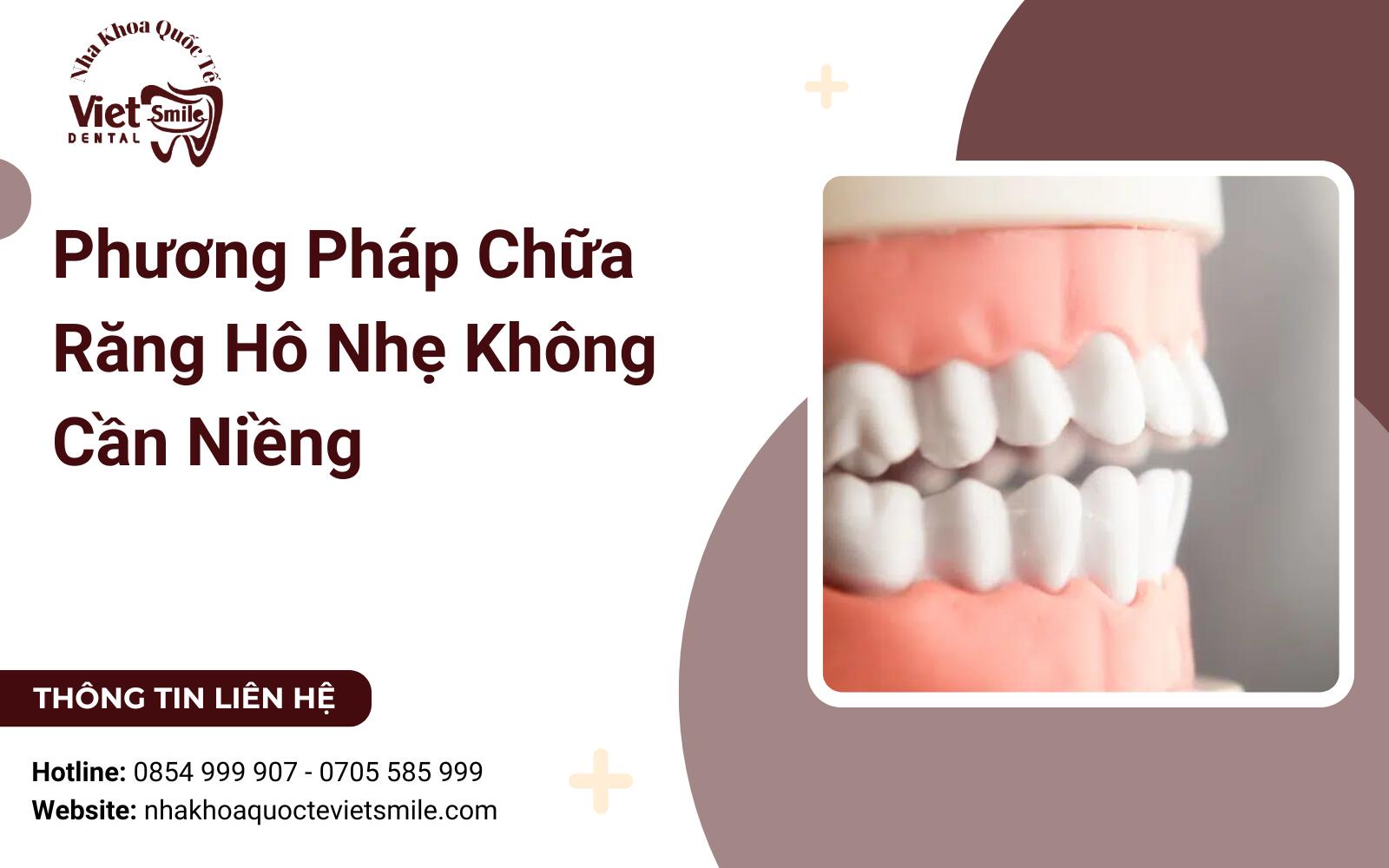 Phương Pháp Chữa Răng Hô Nhẹ Không Cần Niềng