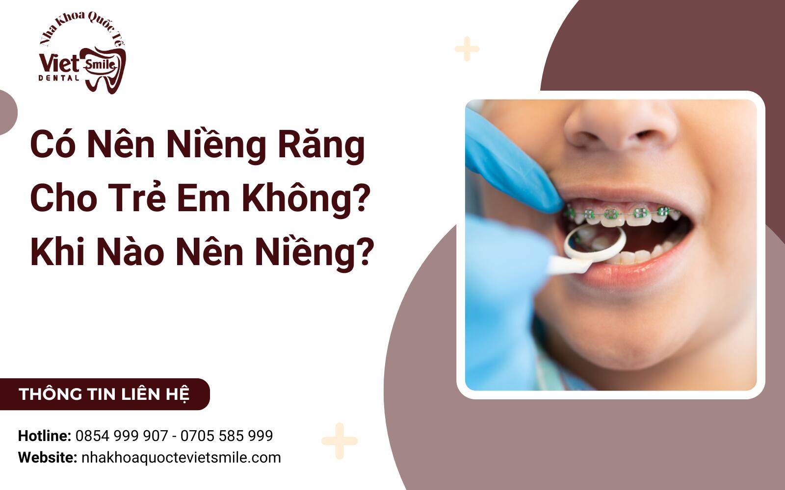 Có Nên Niềng Răng Cho Trẻ Em Không? Khi Nào Nên Niềng?