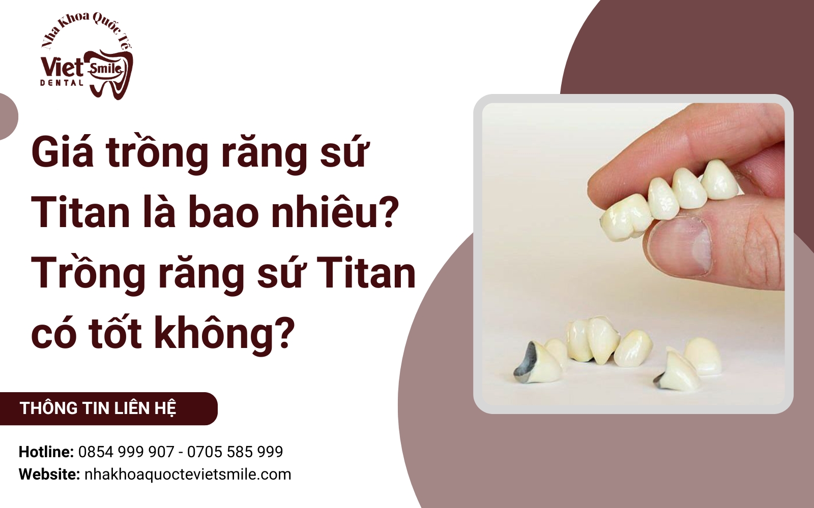 Giá trồng răng sứ Titan là bao nhiêu? Trồng răng sứ Titan có tốt không?