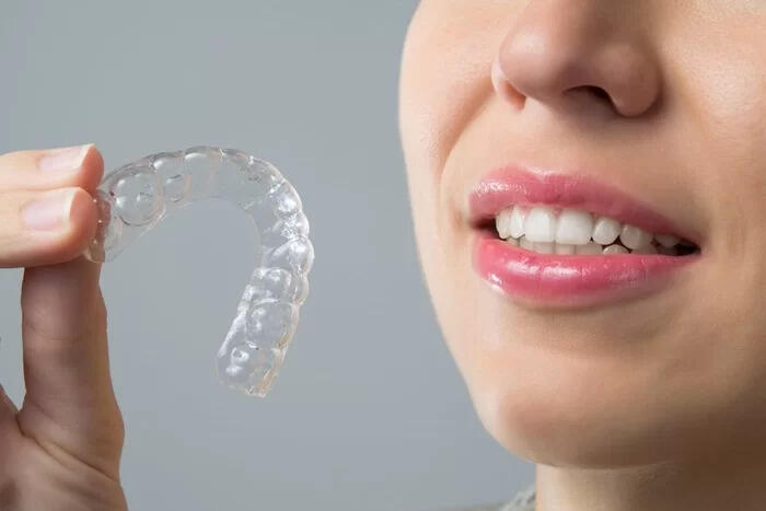 Khay niềng răng Clear Aligner