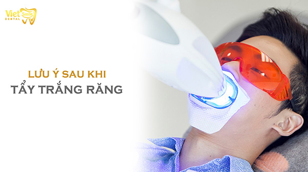 Những lưu ý sau khi tẩy trắng răng mà bạn nên biết