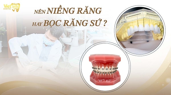 Nên niềng răng hay bọc sứ và một số lưu ý bạn nên biết