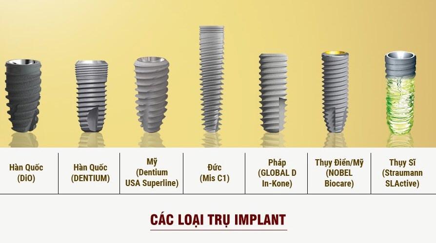 Trồng răng implant có mấy loại? Phổ biến nhất là những loại nào?