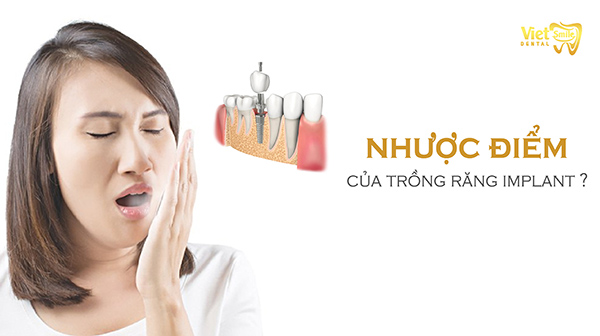 6 nhược điểm của trồng răng Implant đáng chú ý