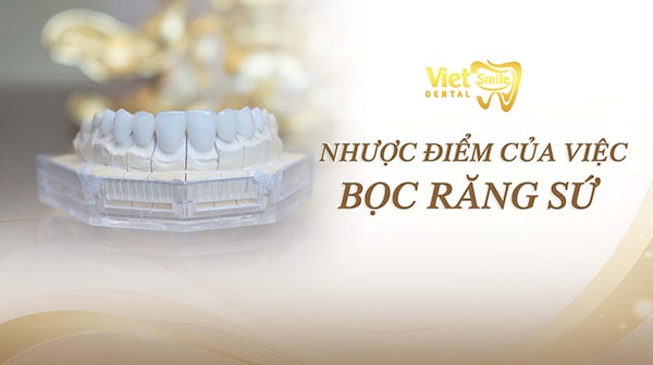 Những nhược điểm của việc bọc răng sứ mà bạn nên biết