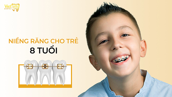 Niềng răng cho trẻ 8 tuổi có quá sớm hay không?