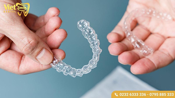 Niềng răng trong suốt Invisalign