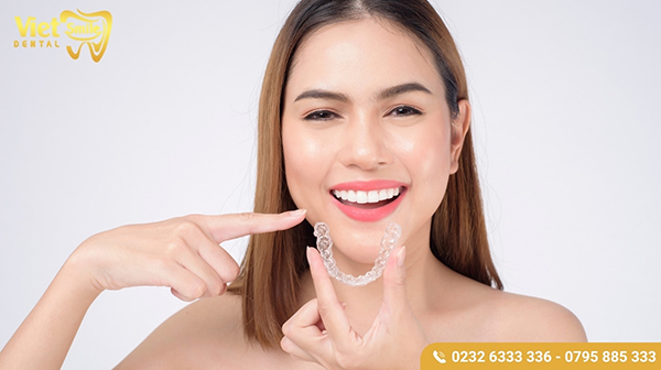 Niềng răng Invisalign