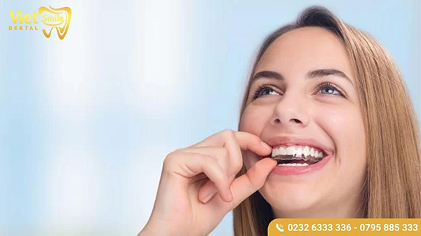 Niềng răng invisalign là gì?