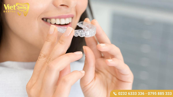 Niềng răng invisalign có ưu và nhược điểm gì? Có đau không?