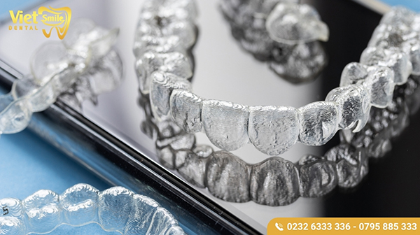 Quy trình niềng răng không mắc cài invisalign tiến hành như thế nào?