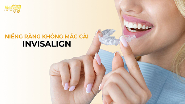 Niềng răng không mắc cài invisalign và những điều cần biết