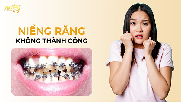 Niềng răng không thành công: Nguyên nhân và cách khắc phục