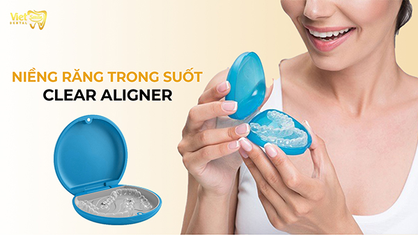 Niềng răng trong suốt Clear Aligner là gì? Ai là người nên sử dụng?