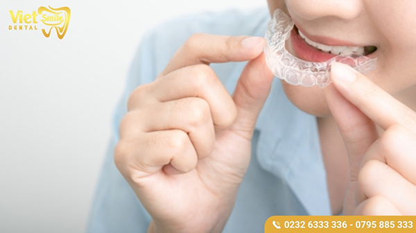 Niềng invisalign có hiệu quả không?