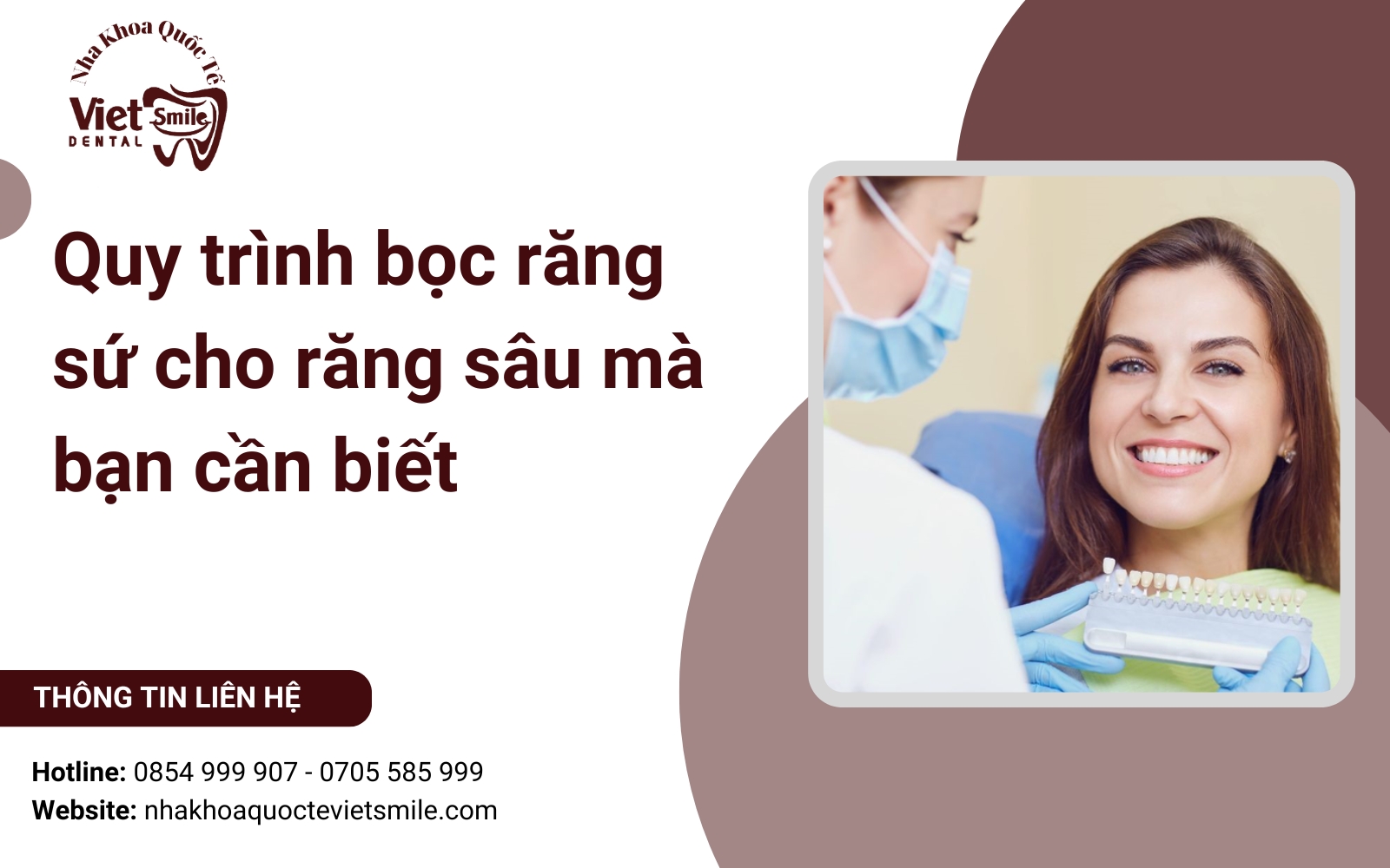 Quy trình bọc răng sứ cho răng sâu mà bạn cần biết