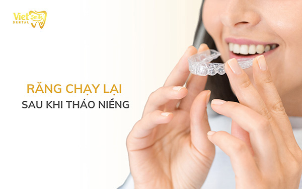 Răng chạy lại sau khi tháo niềng nguyên nhân do đâu?