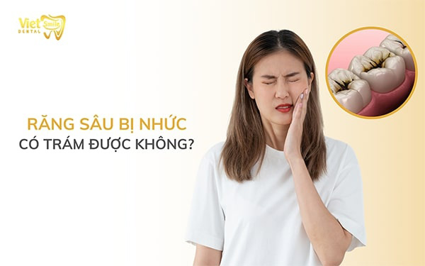 Răng sâu bị nhức có trám được không?