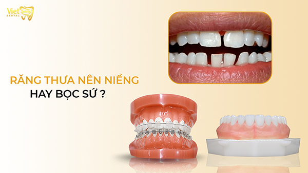 Răng thưa nên niềng hay bọc sứ để đạt hiệu quả cao nhất?