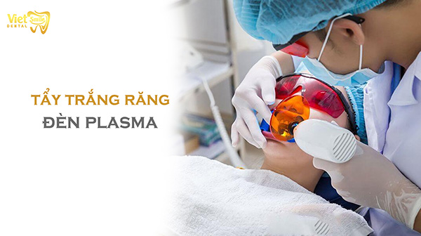 Tẩy trắng răng bằng đèn Plasma có thực sự hiệu quả?