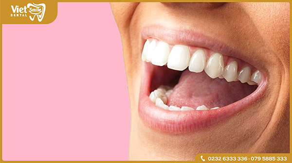 Tại sao tẩy trắng răng bằng Laser Whitening lại được ưa chuộng đến vậy?