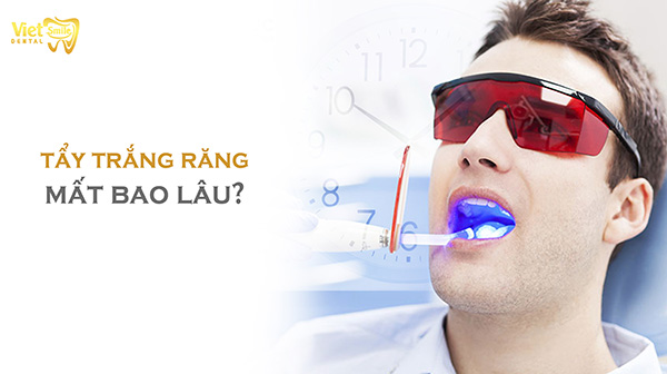 Tẩy trắng răng mất bao lâu thì đem lại hiệu quả tốt nhất?