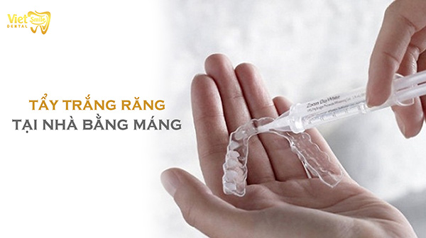 Phương pháp tẩy trắng răng tại nhà bằng máng có thực sự hiệu quả?