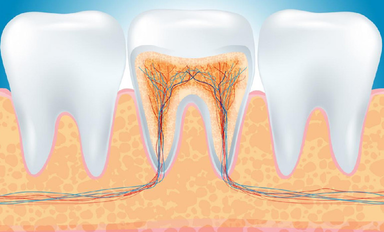 Trám răng sâu lấy tủy giá bao nhiêu tiền