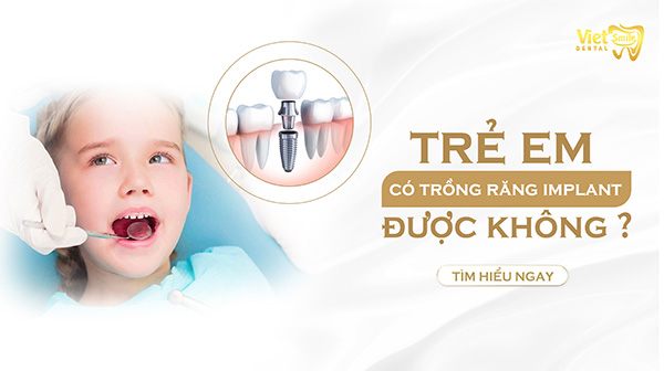 Trẻ em có trồng răng implant được không?