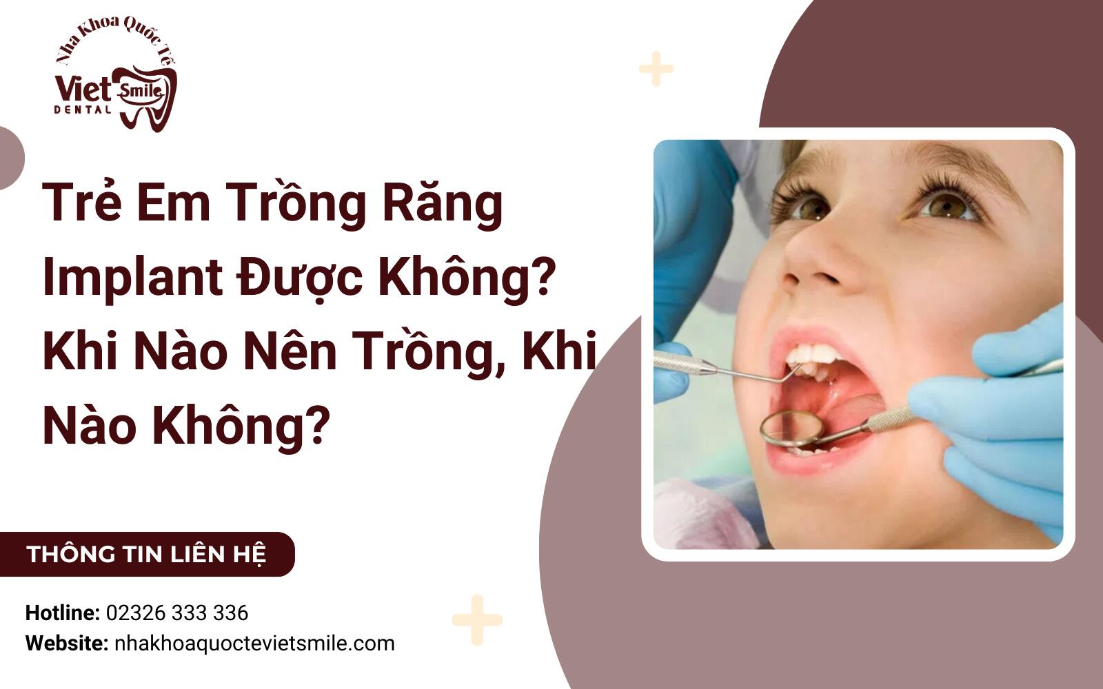 Trẻ Em Trồng Răng Implant Được Không? Khi Nào Nên Trồng, Khi Nào Không?