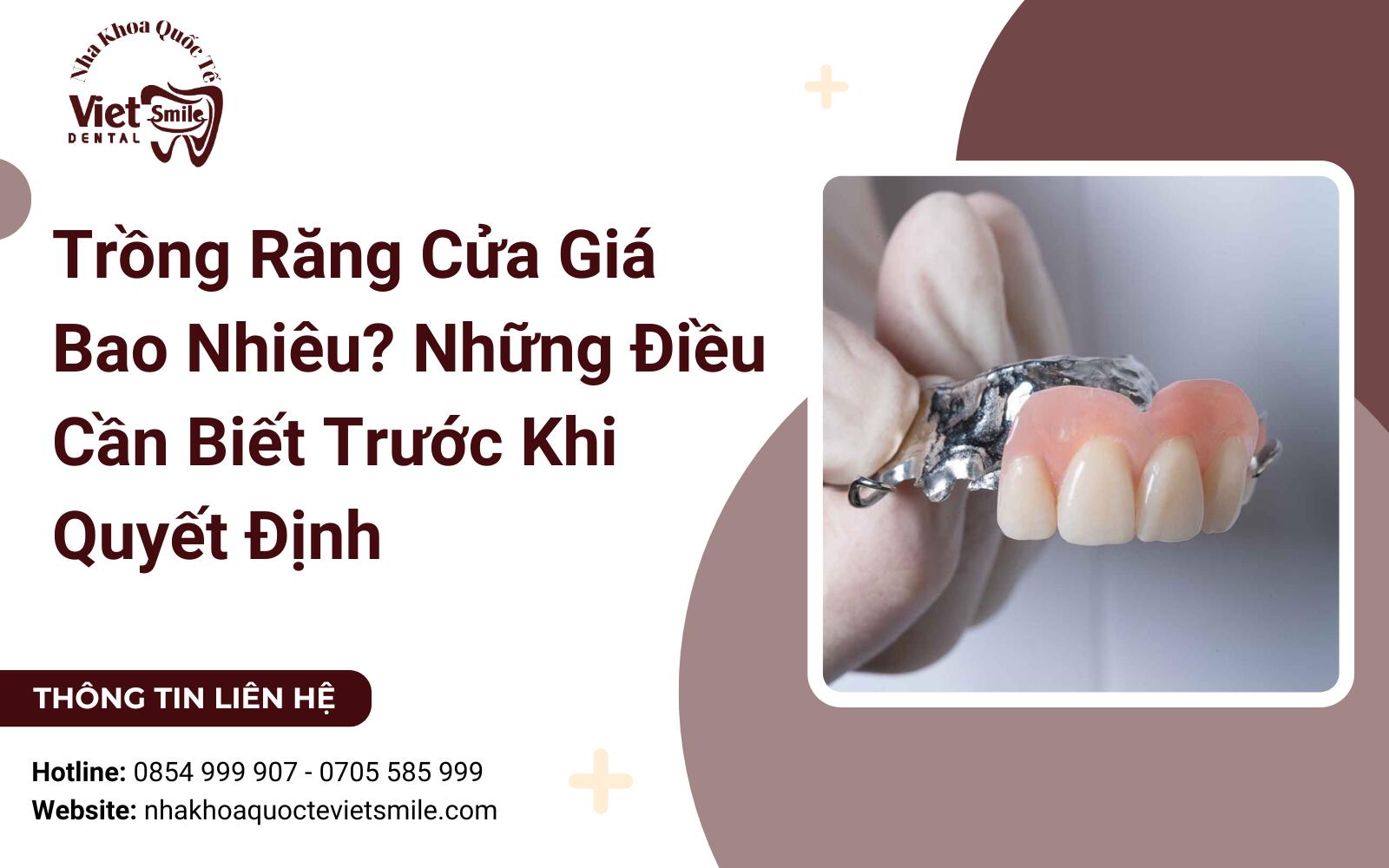 Trồng Răng Cửa Giá Bao Nhiêu? Những Điều Cần Biết Trước Khi Quyết Định