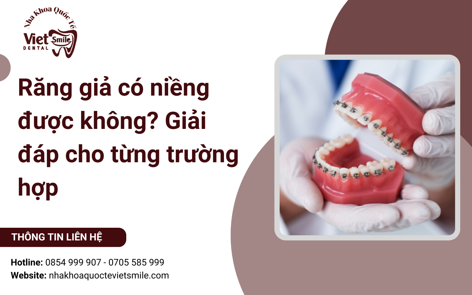 Răng giả có niềng được không? Giải đáp cho từng trường hợp