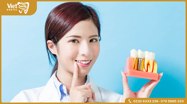 Chế độ chăm sóc răng miệng sau khi trồng răng Implant