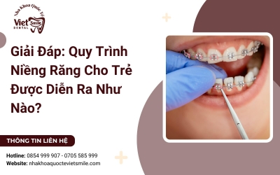 Giải Đáp: Quy Trình Niềng Răng Cho Trẻ Được Diễn Ra Như Nào? Giải Đáp: Quy Trình Niềng Răng Cho Trẻ Được Diễn Ra Như Nào?