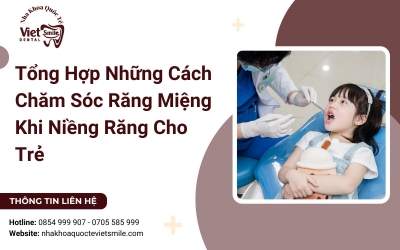 Tổng Hợp Những Cách Chăm Sóc Răng Miệng Khi Niềng Răng Cho Trẻ Tổng Hợp Những Cách Chăm Sóc Răng Miệng Khi Niềng Răng Cho Trẻ