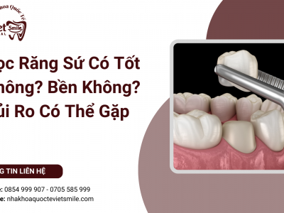 Bọc Răng Sứ Có Tốt Không? Bền Không? Rủi Ro Có Thể Gặp Bọc Răng Sứ Có Tốt Không? Bền Không? Rủi Ro Có Thể Gặp