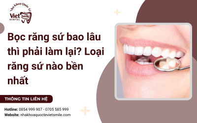 Bọc răng sứ bao lâu thì phải làm lại? Loại răng sứ nào bền nhất Bọc răng sứ bao lâu thì phải làm lại? Loại răng sứ nào bền nhất