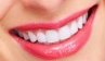 Bọc răng sứ thẩm mỹ Bọc răng sứ thẩm mỹ