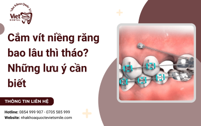 Cắm vít niềng răng bao lâu thì tháo? Cắm vít niềng răng bao lâu thì tháo?