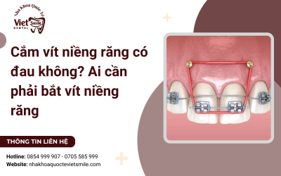 Cắm vít niềng răng có đau không? Ai cần phải bắt vít niềng răng Cắm vít niềng răng có đau không? Ai cần phải bắt vít niềng răng