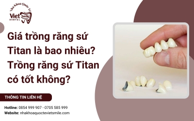 Giá trồng răng sứ Titan là bao nhiêu? Trồng răng sứ Titan có tốt không? Giá trồng răng sứ Titan là bao nhiêu? Trồng răng sứ Titan có tốt không?